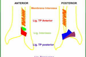 Tobillo: anatomía y lesiones ligamentarias